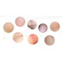 10ml Essence full-body whitening chicken skin repair essential oils remove dead skin goose bumps pimples folliculitis SM6