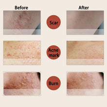 10ml Essence full-body whitening chicken skin repair essential oils remove dead skin goose bumps pimples folliculitis SM6