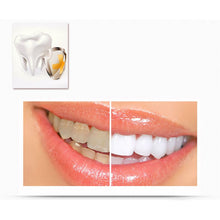 2ml Transparent White Teeth High Strength Whitening Gel Pen Whitener Tooth Pen Dental Equipment LE2 SM6