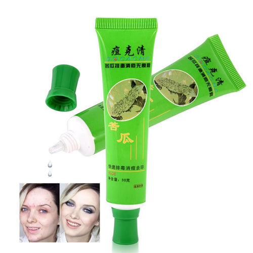 30g Acne Cream Blain Products Desalt Blain To Imprint Face Cream Face Treatment SM6