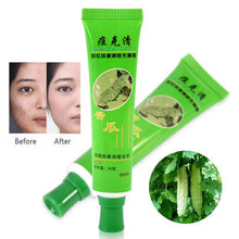 30g Acne Cream Blain Products Desalt Blain To Imprint Face Cream Face Treatment SM6