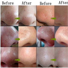 AFY Skin Care Suction Black Mask Bamboo Charcoal Blackhead Remover Nose Face Facial Mask Tearing Peeling Shrink Pores L4 SM6