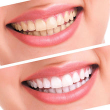 Teeth Whitening 44% Peroxide Dental Bleaching System Oral Gel Kit Tooth Whitener Dental Equipment SM6