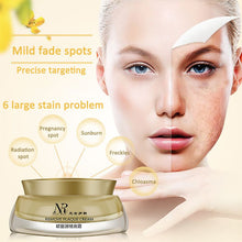 Women Face Skin Whitening Remove Freckle Speckle Peel Dark Spot Wrinkles Cream SM6