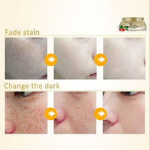 Women Face Skin Whitening Remove Freckle Speckle Peel Dark Spot Wrinkles Cream SM6