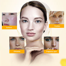 Women Face Skin Whitening Remove Freckle Speckle Peel Dark Spot Wrinkles Cream SM6
