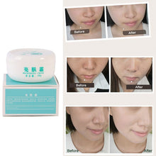 Powerful whitening Freckle cream Remove melasma Acne Spots pigment Melanin face care cream L4 SM6